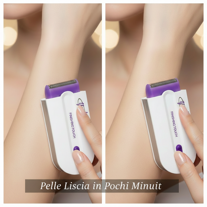 Epilatore a Luce Pulsata IPL™ — Epilazione Definitiva a Casa